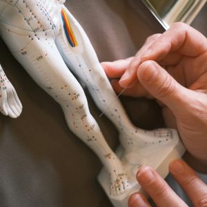 5 Centros de acupuntura en Sevilla