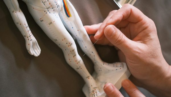 5 Centros de acupuntura en Sevilla